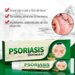 2x1 | Crema Antifúngica y Antipicazón – Tratamiento Natural para Tiña, Hongos y Psoriasis