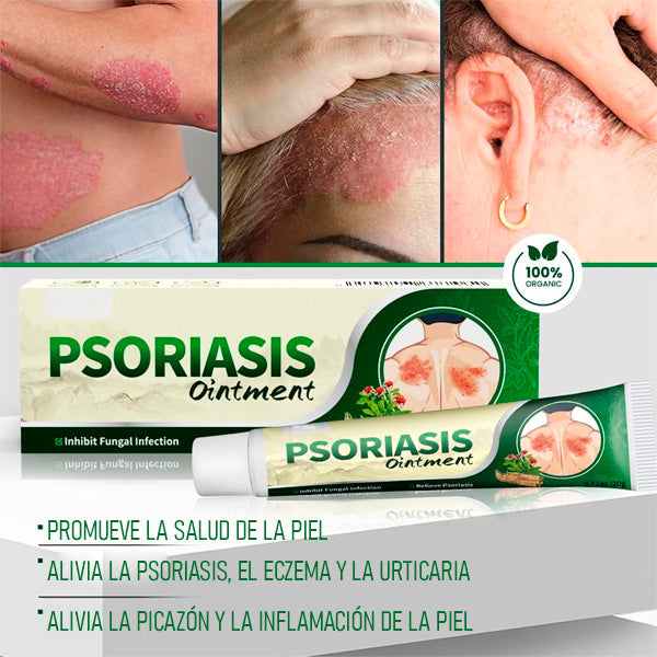 2x1 | Crema Antifúngica y Antipicazón – Tratamiento Natural para Tiña, Hongos y Psoriasis