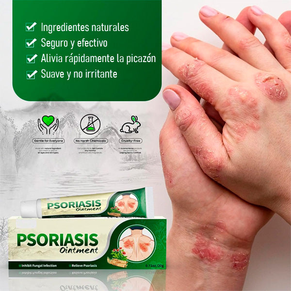 2x1 | Crema Antifúngica y Antipicazón – Tratamiento Natural para Tiña, Hongos y Psoriasis