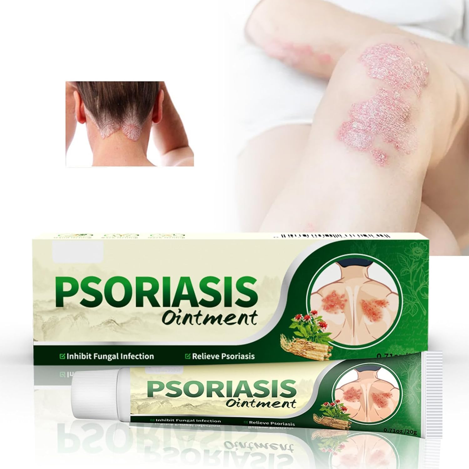 2x1 | Crema Antifúngica y Antipicazón – Tratamiento Natural para Tiña, Hongos y Psoriasis