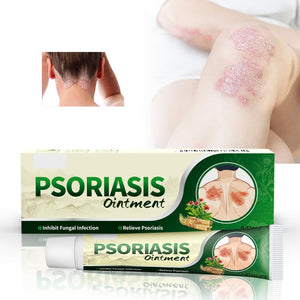 2x1 | Crema Antifúngica y Antipicazón – Tratamiento Natural para Tiña, Hongos y Psoriasis